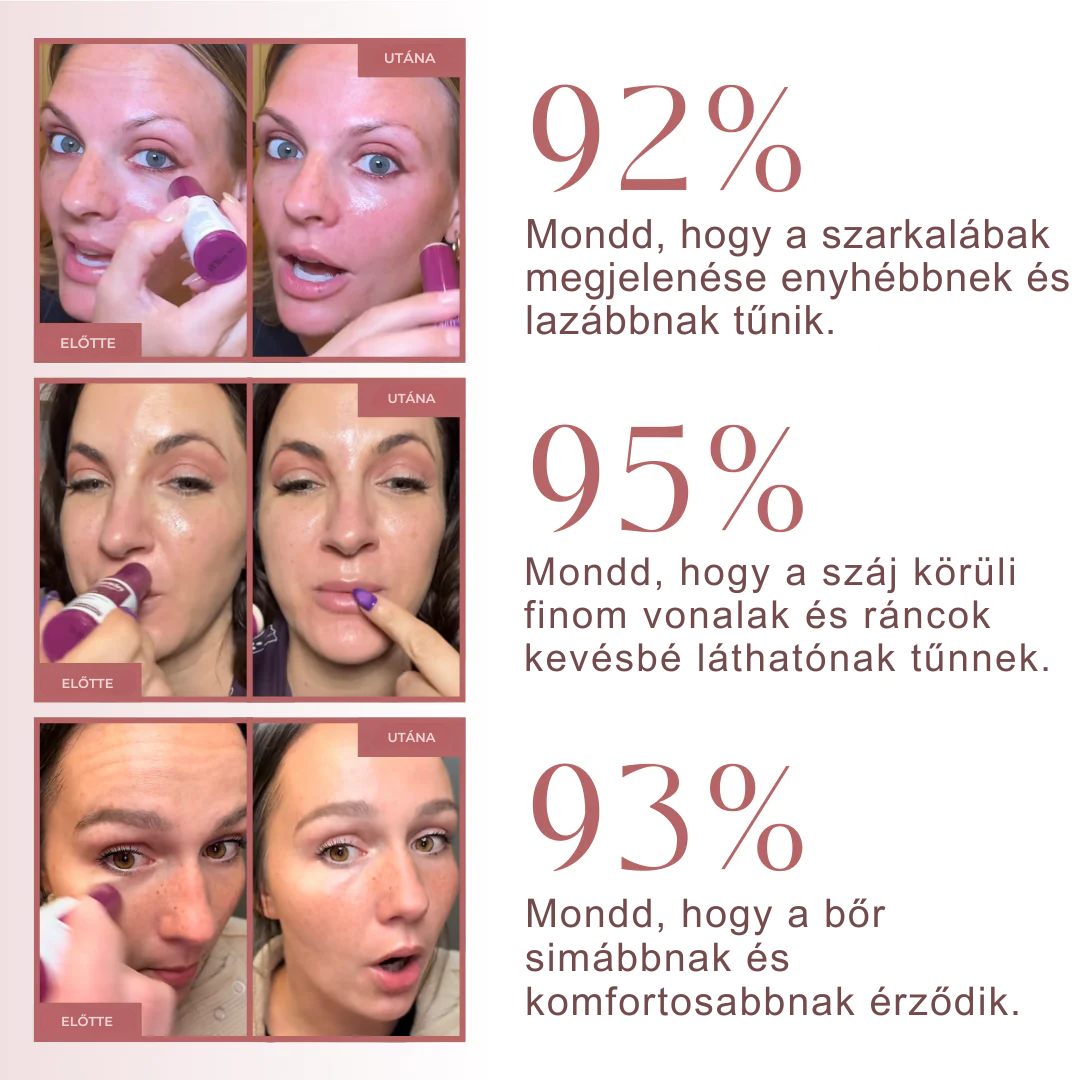 Ránctalanító kalcium balzsam