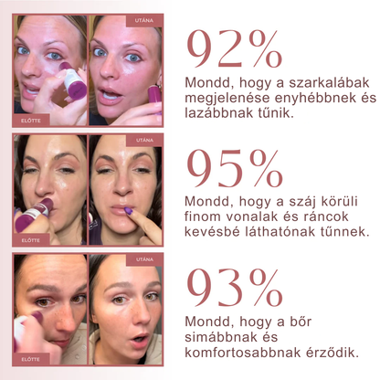Ránctalanító kalcium balzsam